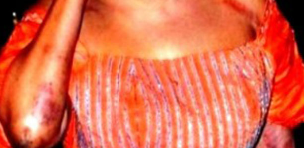 Dépigmentation : La révélation affolante d’une dermatologue