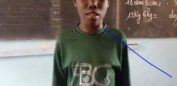 Kaolack : L’Etat interpelé sur la multiplication des salles de classe inclusive