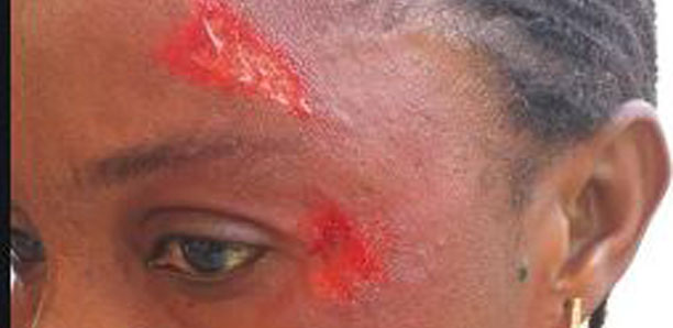 Multiplication des agressions : Les enseignants, dans une colère noire, en action