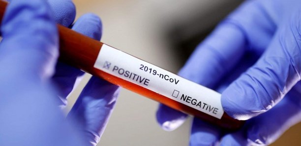 Abdoulaye Diouf Sarr : “Les cas communautaires ont ceinturé le Sénégal” (document)