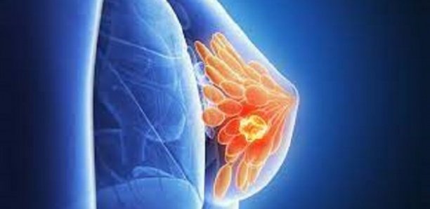 Epidémie de la dengue : la maladie se propage dans le nord du Sénégal