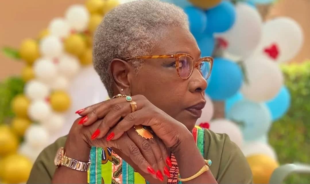 Chronique de l’improvisteGreffages, perruques et paranoïa administrative (Par Henriette Niang Kandé)